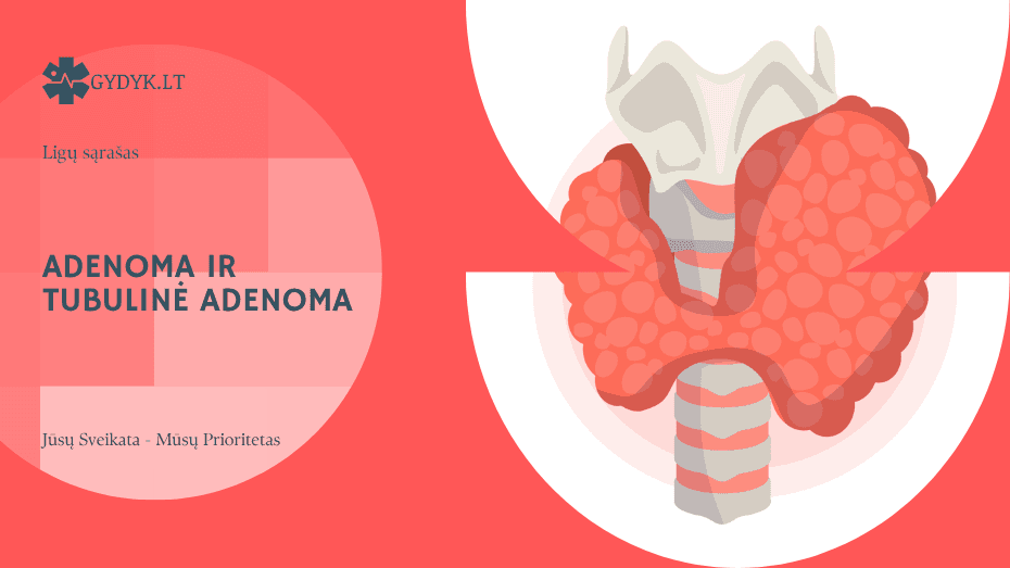 Adenoma ir tubulinė adenoma – pagrindiniai skirtumai bei diagnostika