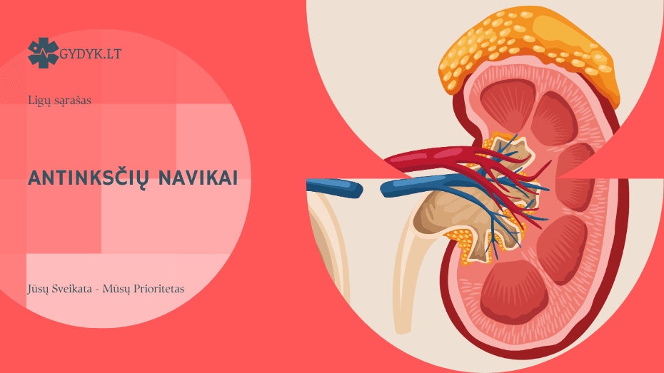 Antinksčių navikai: simptomai, diagnostika ir gydymo galimybės