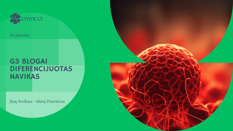 G3 blogai diferencijuotas navikas: ką reiškia ši diagnozė?