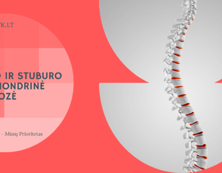 Klubo ir stuburo subchondrinė sklerozė: ką rodo ši diagnozė?