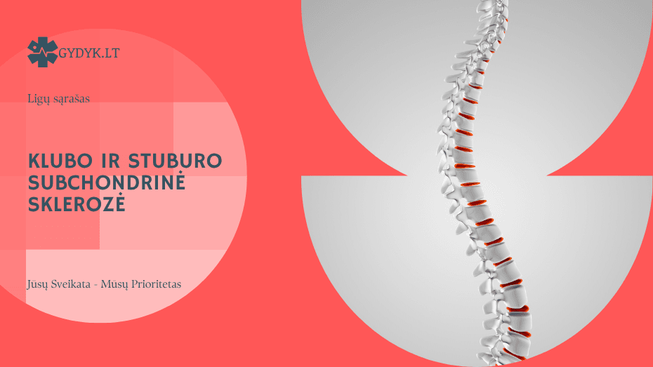 Klubo ir stuburo subchondrinė sklerozė: ką rodo ši diagnozė?