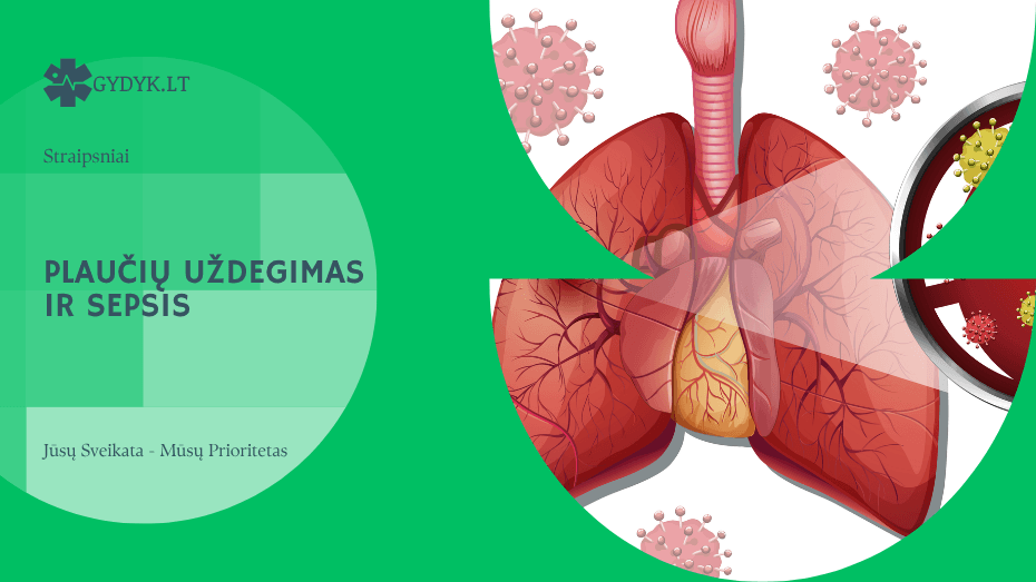Plaučių uždegimas ir sepsis: kada infekcija tampa pavojinga gyvybei?