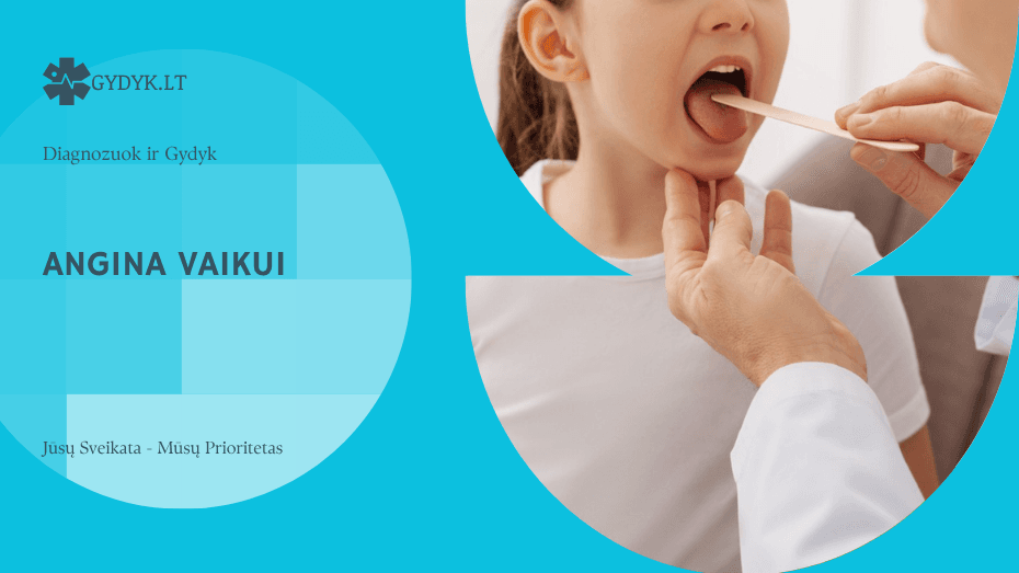 Angina vaikui: simptomai, gydymas ir kada kreiptis į gydytoją?