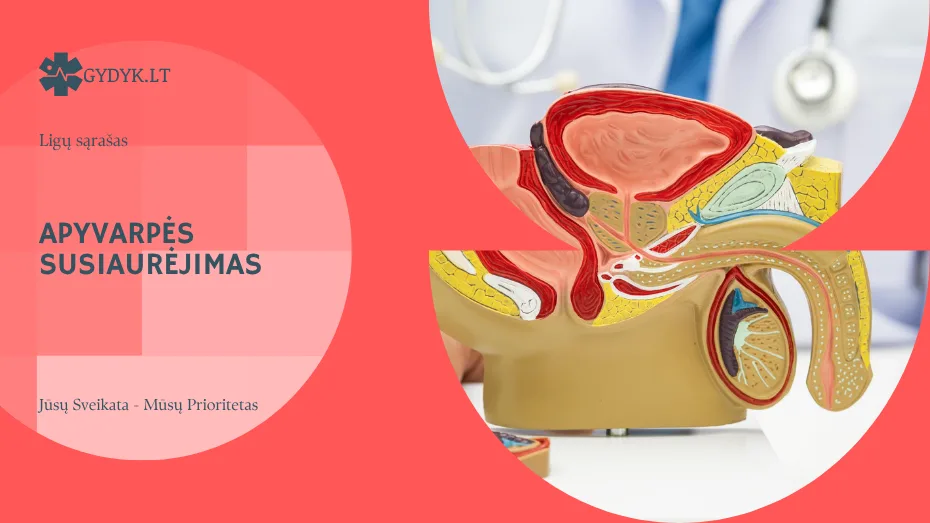 Apyvarpės susiaurėjimas: simptomai, priežastys ir gydymas Apyvarpės susiaurėjimas: simptomai, priežastys ir gydymas