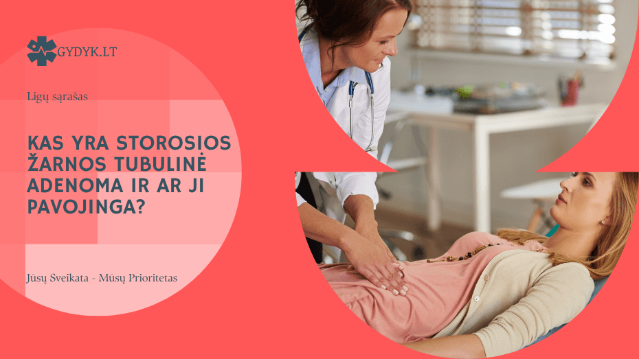 Kas yra storosios žarnos tubulinė adenoma ir ar ji pavojinga?