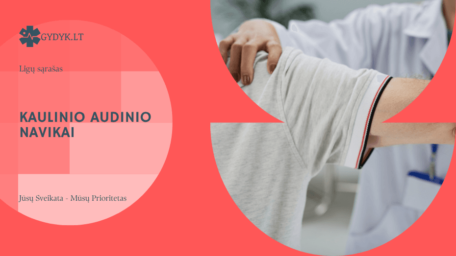 Kaulinio audinio navikai: simptomai, priežastys, diagnostika ir gydymas