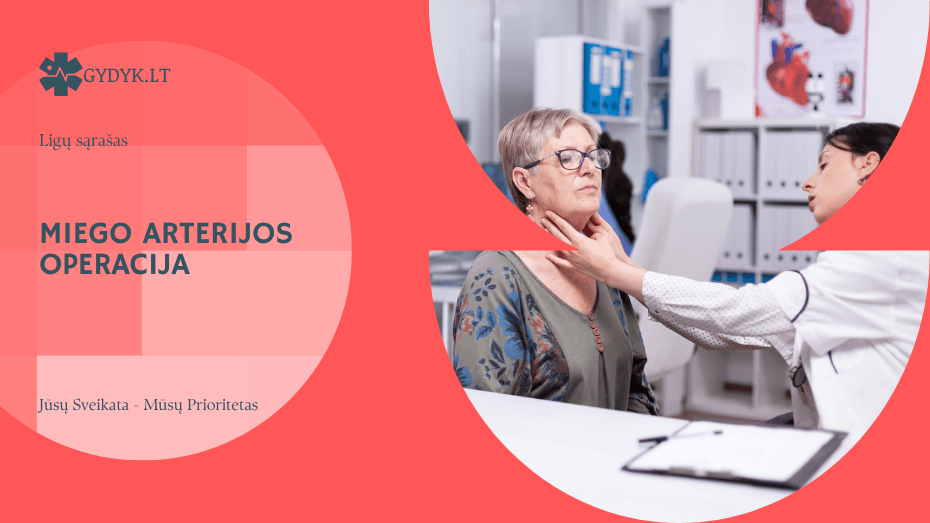 Miego arterijos operacija: stentavimas, reabilitacija ir gydymo galimybės