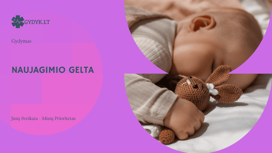 Naujagimio gelta: bilirubino normos, simptomai ir gydymas