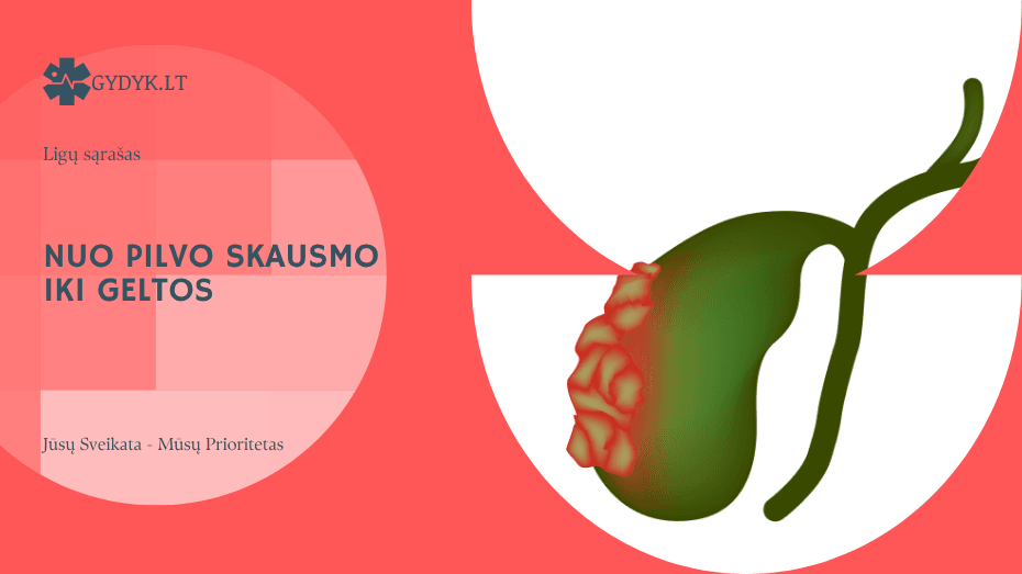 Nuo pilvo skausmo iki geltos: kokie požymiai gali įspėti apie tulžies pūslės vėžį?