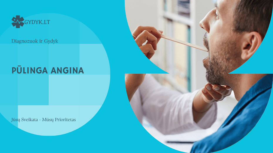 Pūlinga angina: simptomai, kaip atrodo ir kaip gydyti?