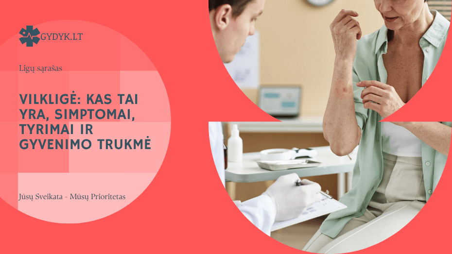 Vilkligė: kas tai yra, simptomai, tyrimai ir gyvenimo trukmė