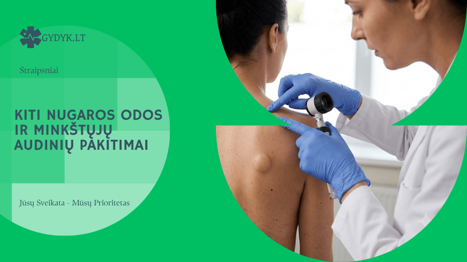 Kiti nugaros odos ir minkštųjų audinių pakitimai: ką svarbu žinoti?