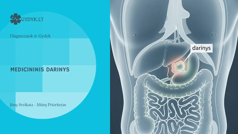 Darinys: kas tai yra medicinoje ir ką reiškia tyrimų atsakymai Iliustracija: Darinys: kas tai yra medicinoje ir ką reiškia tyrimų atsakymai