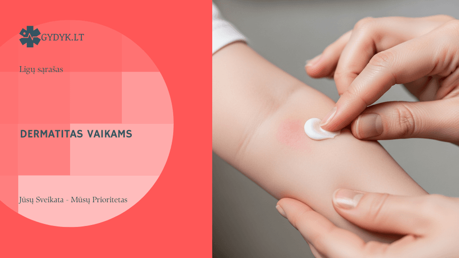 Iliustracija: Dermatitas vaikams ir kūdikiams: priežastys, simptomai ir gydymas
