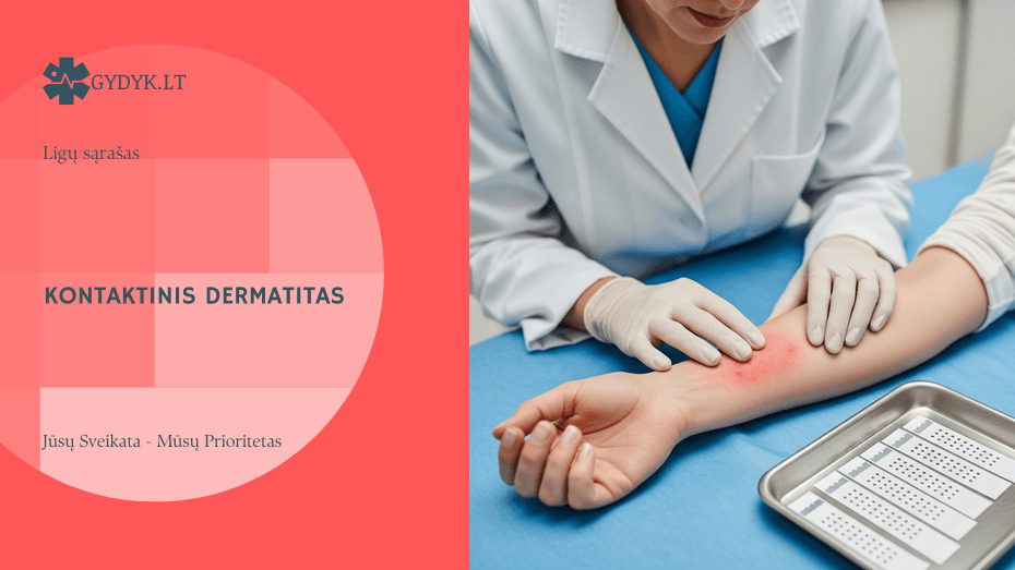 Iliustracija: Kontaktinis ir alerginis dermatitas: priežastys ir gydymas