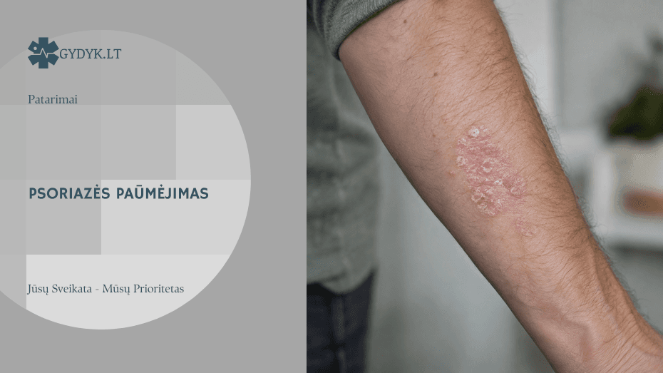 Dilbio oda su nedideliu pleiskanojančiu psoriazės židiniu